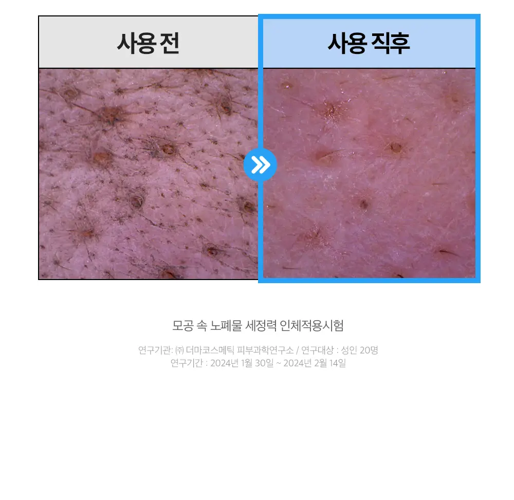 [단독기획/쫀득버블] 듀이트리 하이 아미노 올 효소 파우더워시 50g 기획 (+해면스펀지) 상세페이지 19